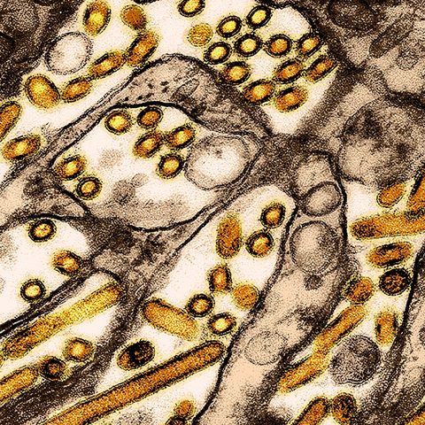 O'nyong'nyong virus electron micrograph