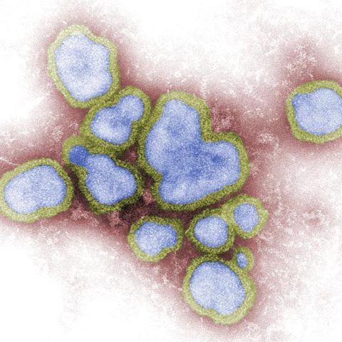 Enterovirus D70 electron micrograph