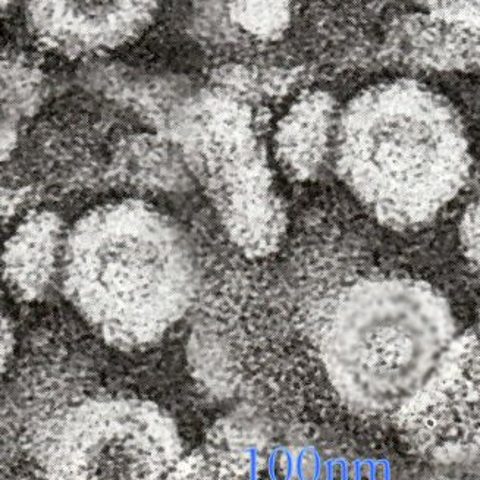 Influenza A H7N9 electron micrograph