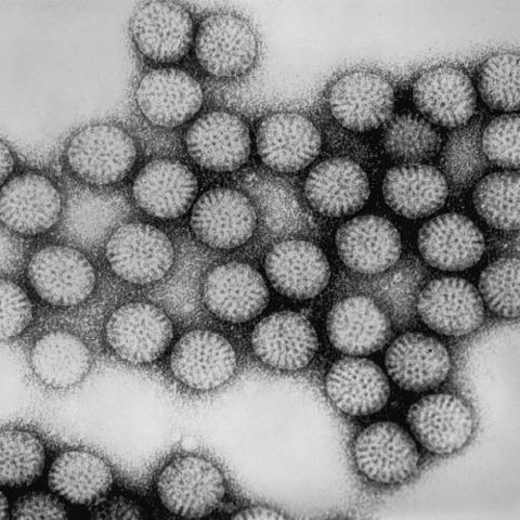 Human parainfluenza virus 3 electron micrograph