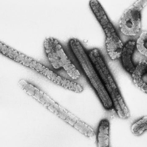 Influenza A H10N8 electron micrograph