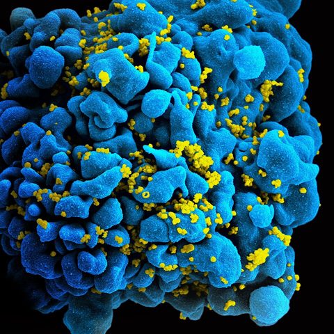 Tick-borne encephalitis virus electron micrograph