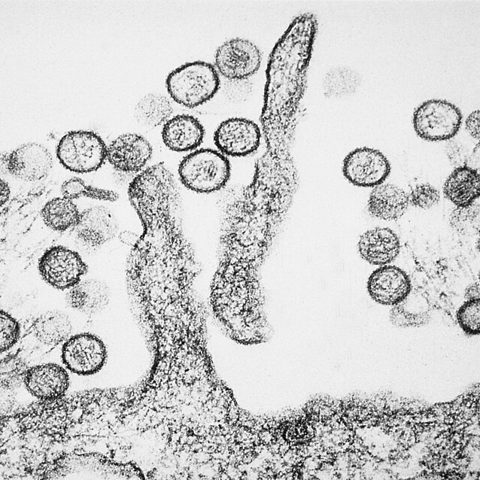 Western equine encephalitis virus electron micrograph