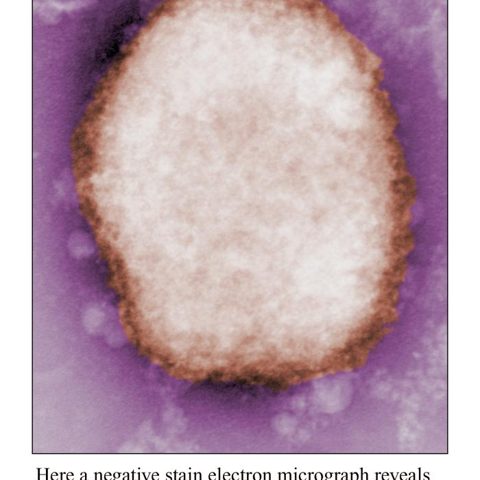 Semliki Forest virus electron micrograph