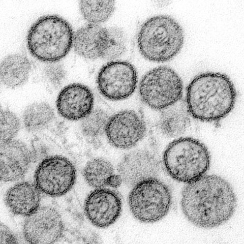 Eastern equine encephalitis virus electron micrograph