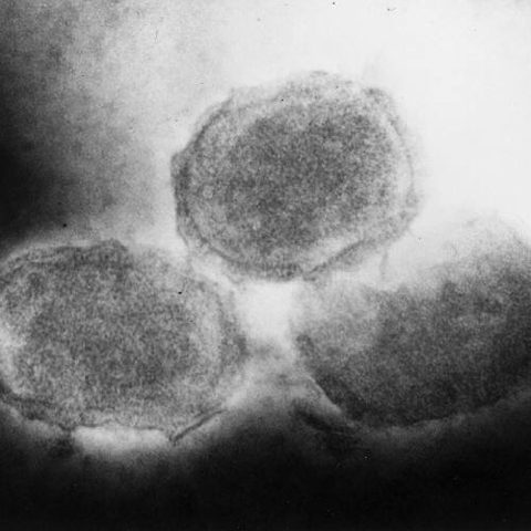 Human parainfluenza virus 2 electron micrograph