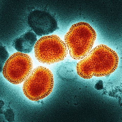 Omsk hemorrhagic fever virus electron micrograph
