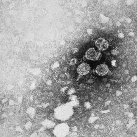 Menangle virus electron micrograph