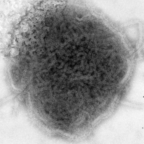 Human T-lymphotropic virus 1 electron micrograph