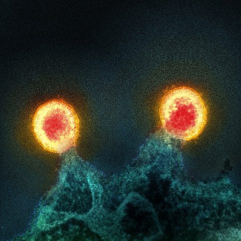 Usutu virus electron micrograph