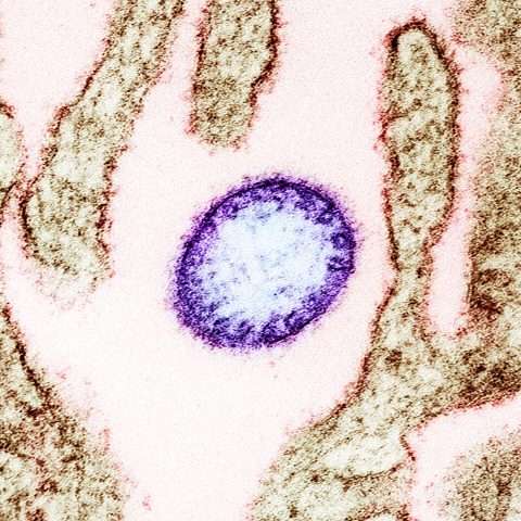 Influenza B Victoria electron micrograph