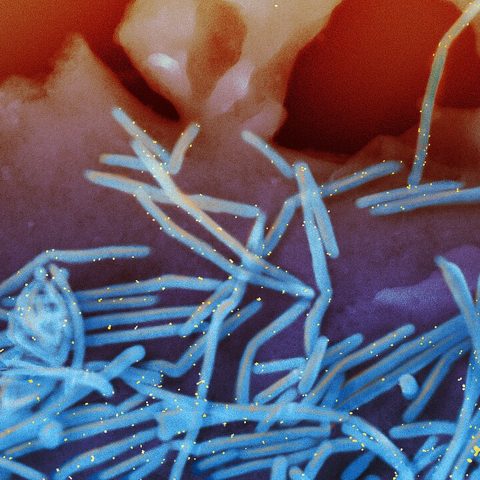Bombali virus electron micrograph