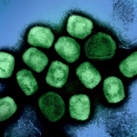 Influenza A H9N2 electron micrograph