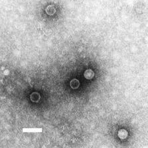 Influenza D electron micrograph