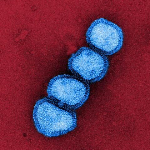 Influenza A H1N1 electron micrograph