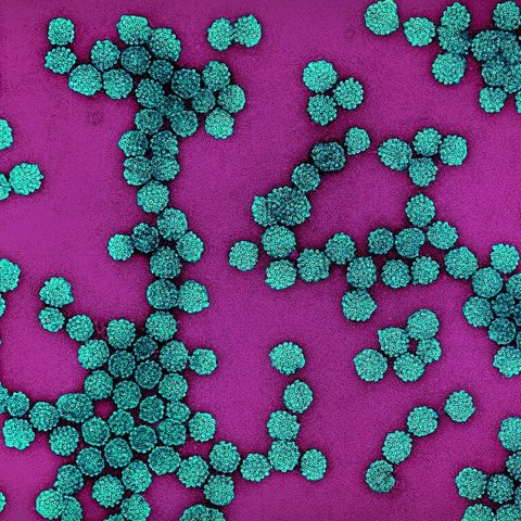 Influenza C electron micrograph
