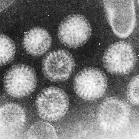 Human coronavirus NL63 electron micrograph