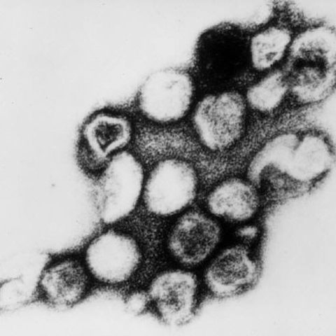 Human T-lymphotropic virus 2 electron micrograph